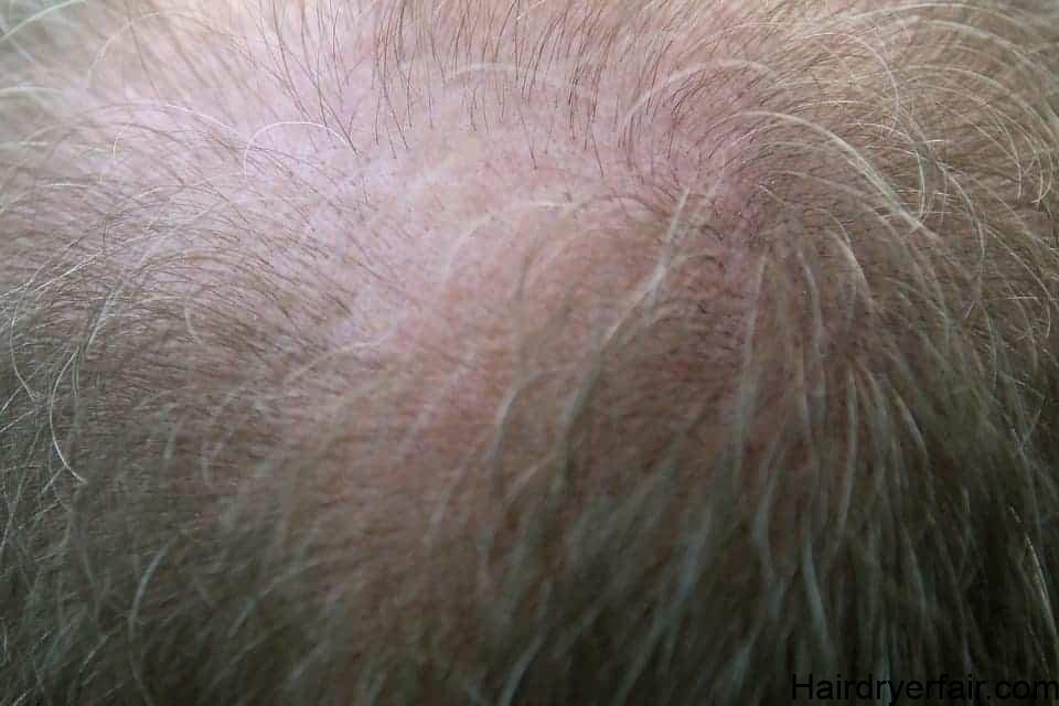 how to hide a bald spot on crown 4