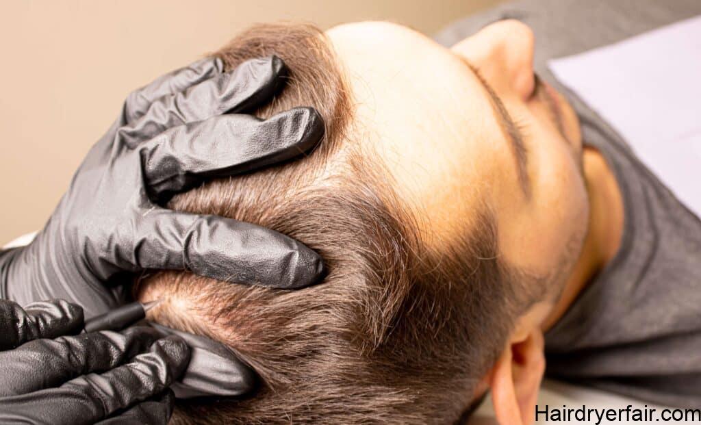 7 Lesser-Known Benefits Of Getting A Hair Tattoo 